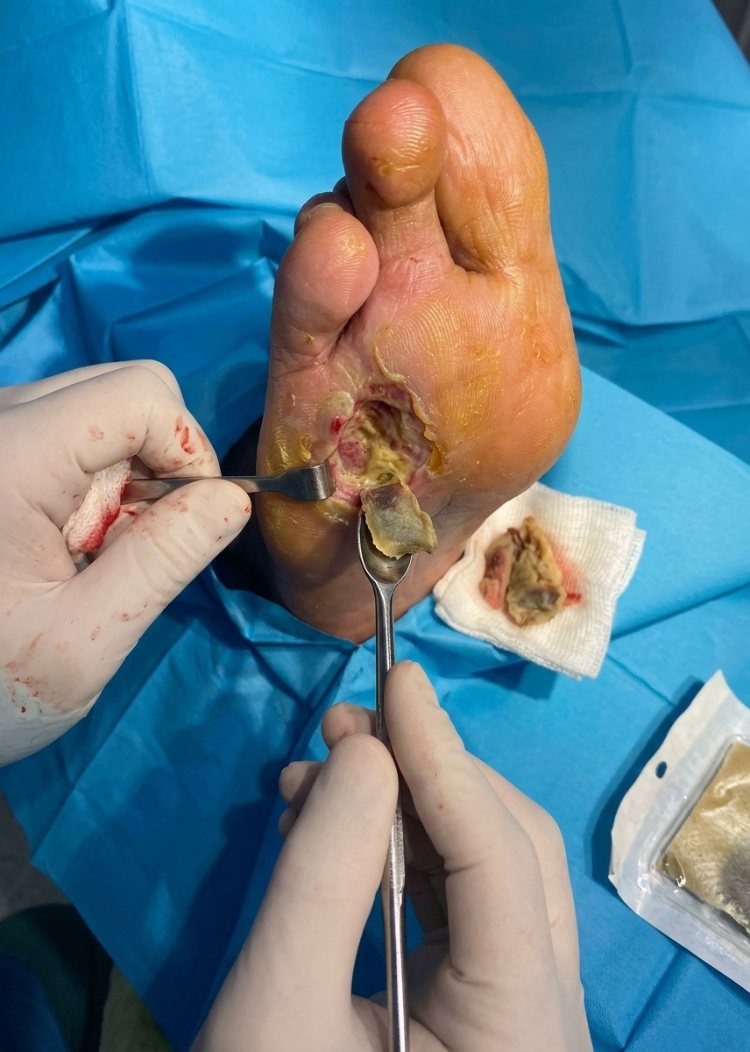 Our Services diabetic foot surgery Our Services diabetic foot surgery